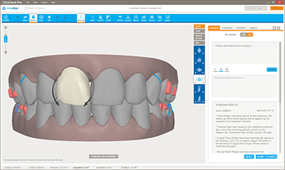 ClinCheck 3D treatment planning software interface